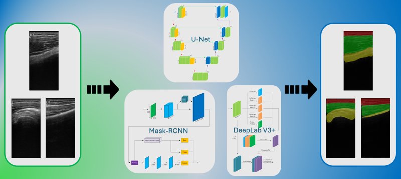 IEEE Access - Ultrasound Segmentation